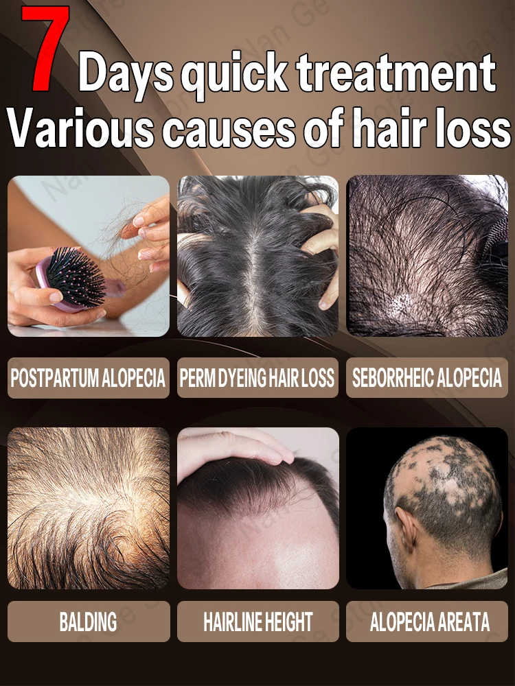 Масло за растежа на косата Унисекс За лечение на косопад, за Бърз растеж на косата Ефективно лечение на Наследствено оплешивяване Послеродовое косопад Изображение 4