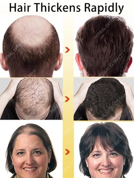 Масло за възстановяване на растежа на косата, Оплешивяване Защита от Косопад Възстановяване на космените фоликули Бързо Прераждане на косата