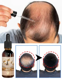 Масло за растежа на косата Унисекс За лечение на косопад, за Бърз растеж на косата Ефективно лечение на Наследствено оплешивяване Послеродовое косопад